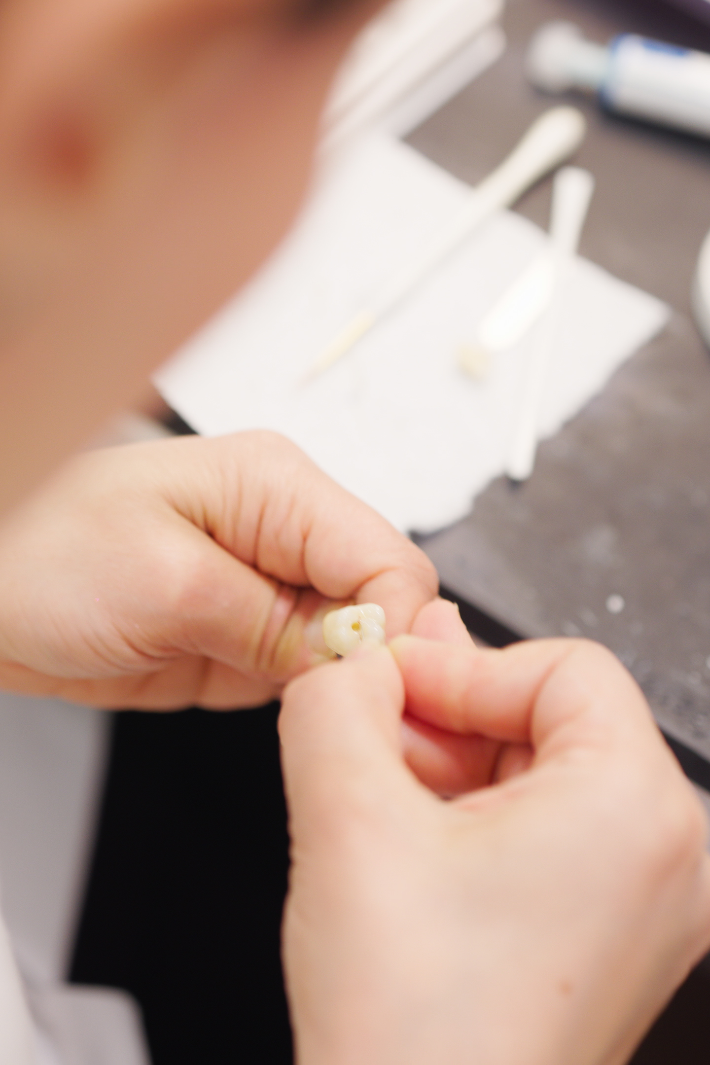 Dr. Nick Ciardiello of Limitless Dental in Jersey City holding a freshly extracted molar tooth with the roots visible, illustrating how the blood clot protects the socket and prevents dry socket.